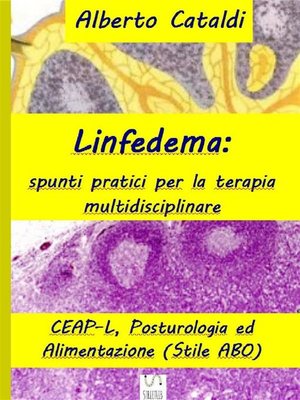 cover image of Linfedema
